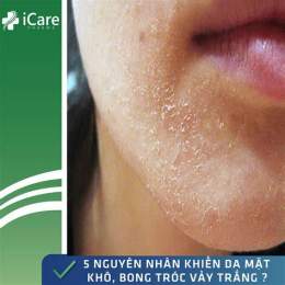 ảnh chụp màn hình cách trị da mặt khô bong tróc tại nhà