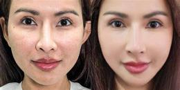 ảnh chụp màn hình căng bóng da mặt
