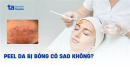 ảnh chụp màn hình peel da bị bỏng