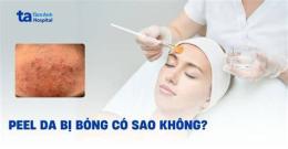 ảnh chụp màn hình peel da ko bong