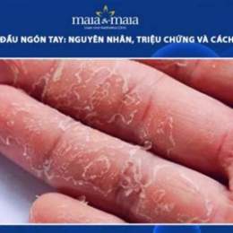bị bong da đầu ngón tay