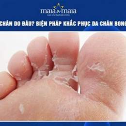 da chân khô bong tróc