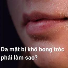 da mặt bị bong tróc đỏ rát phải làm sao