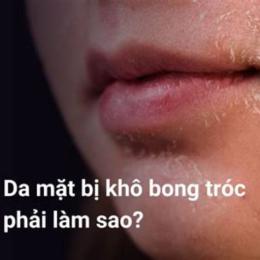 da mặt bị khô bong tróc phải làm sao