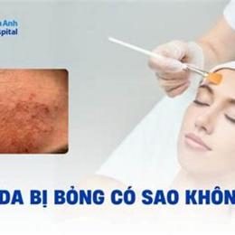 dấu hiệu peel da bị bỏng