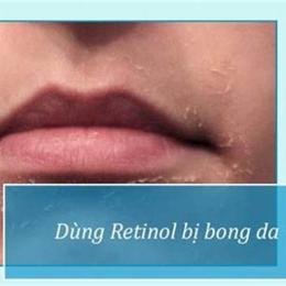 dùng retinol bị bong da