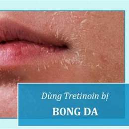 dùng tretinoin bị bong da nên làm gì