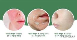 giao diện app peel da bao lâu bong