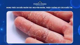 giao diện app thuốc đặc trị bong tróc da tay