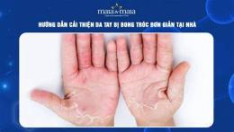 hướng dẫn sử dụng bong tróc da tay