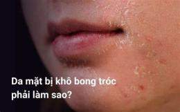 hướng dẫn sử dụng da bị khô bong tróc