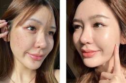 tính năng nổi bật căng bóng da mặt