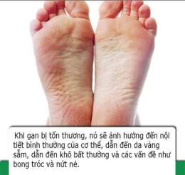 tính năng nổi bật chân bị bong da