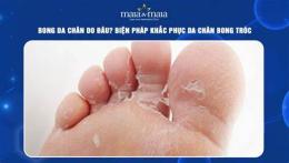 tính năng nổi bật da chân bị bong tróc