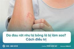 tính năng nổi bật da đau rát như bị bỏng