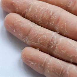 tính năng nổi bật da tay bị khô bong tróc