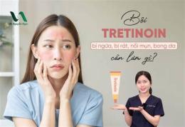 tính năng nổi bật dùng tretinoin bị bong da nên làm gì
