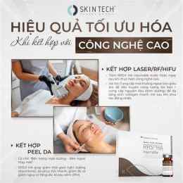 tính năng nổi bật làm sao để peel da nhanh bong