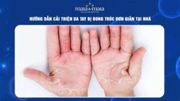 tính năng nổi bật tại sao da tay bị bong tróc