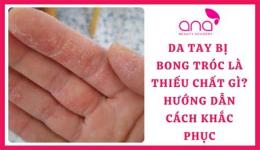 tính năng nổi bật tay bị bong da là thiếu chất gì